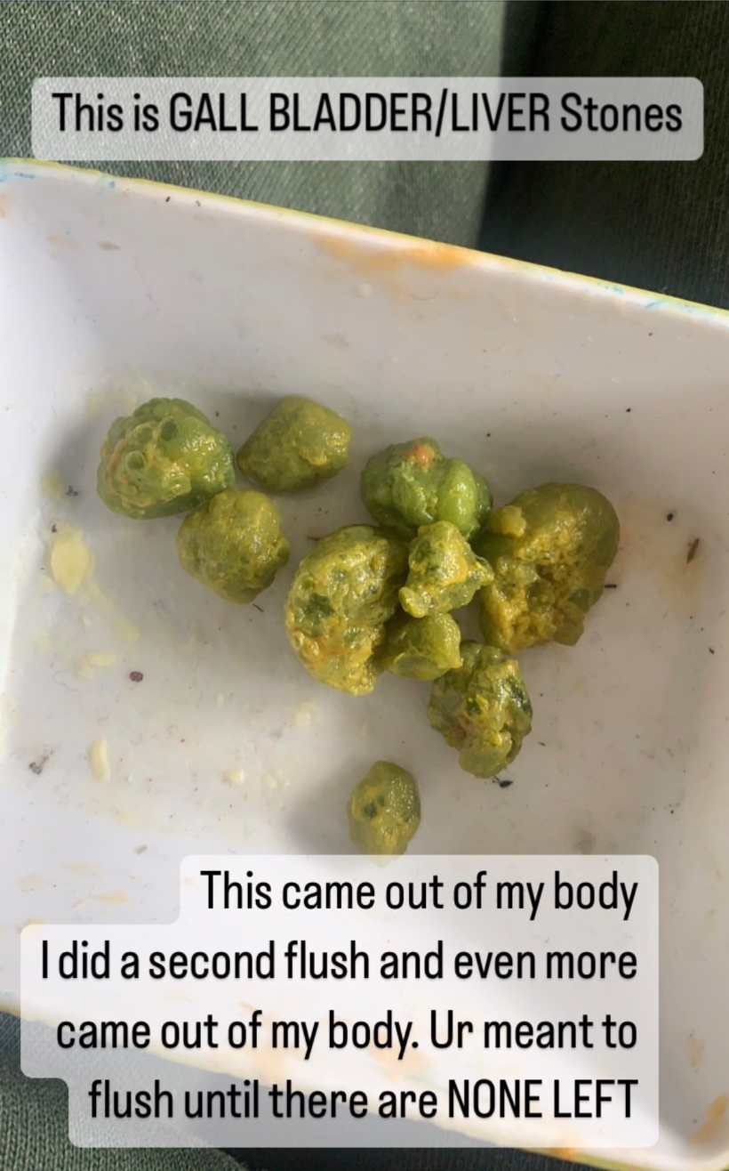 Liver + Gallbladder Flush Protocol