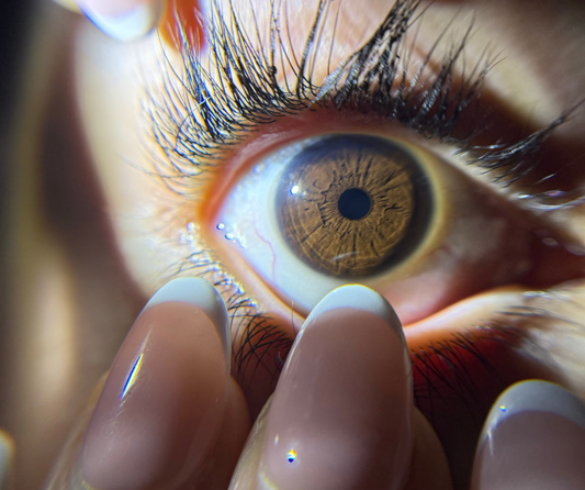 Holistic Iris Health Summary